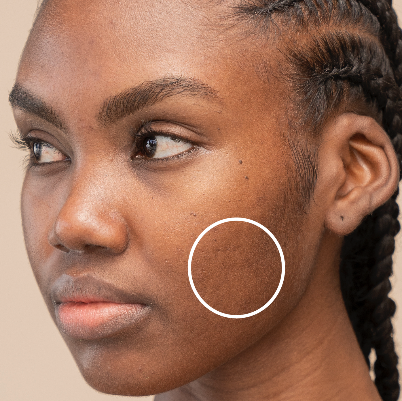 African american woman with hyperpigmentation and scars