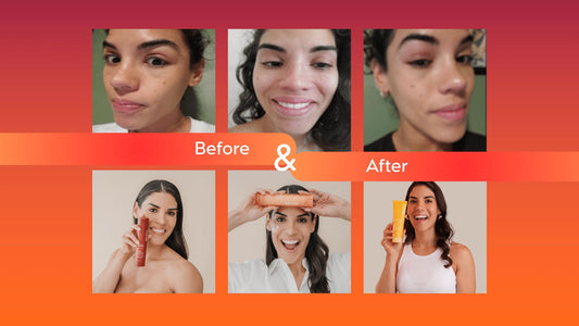 What 6 Years of Testing Taught Us About Sensitive Skin - BEJOU