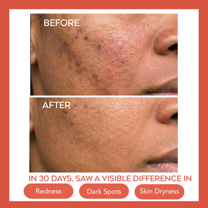 Hydrating Dew Moisturizer