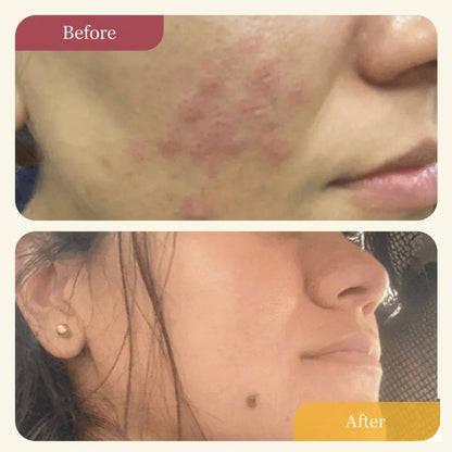 Refillable Clear Confidence Moisturizer