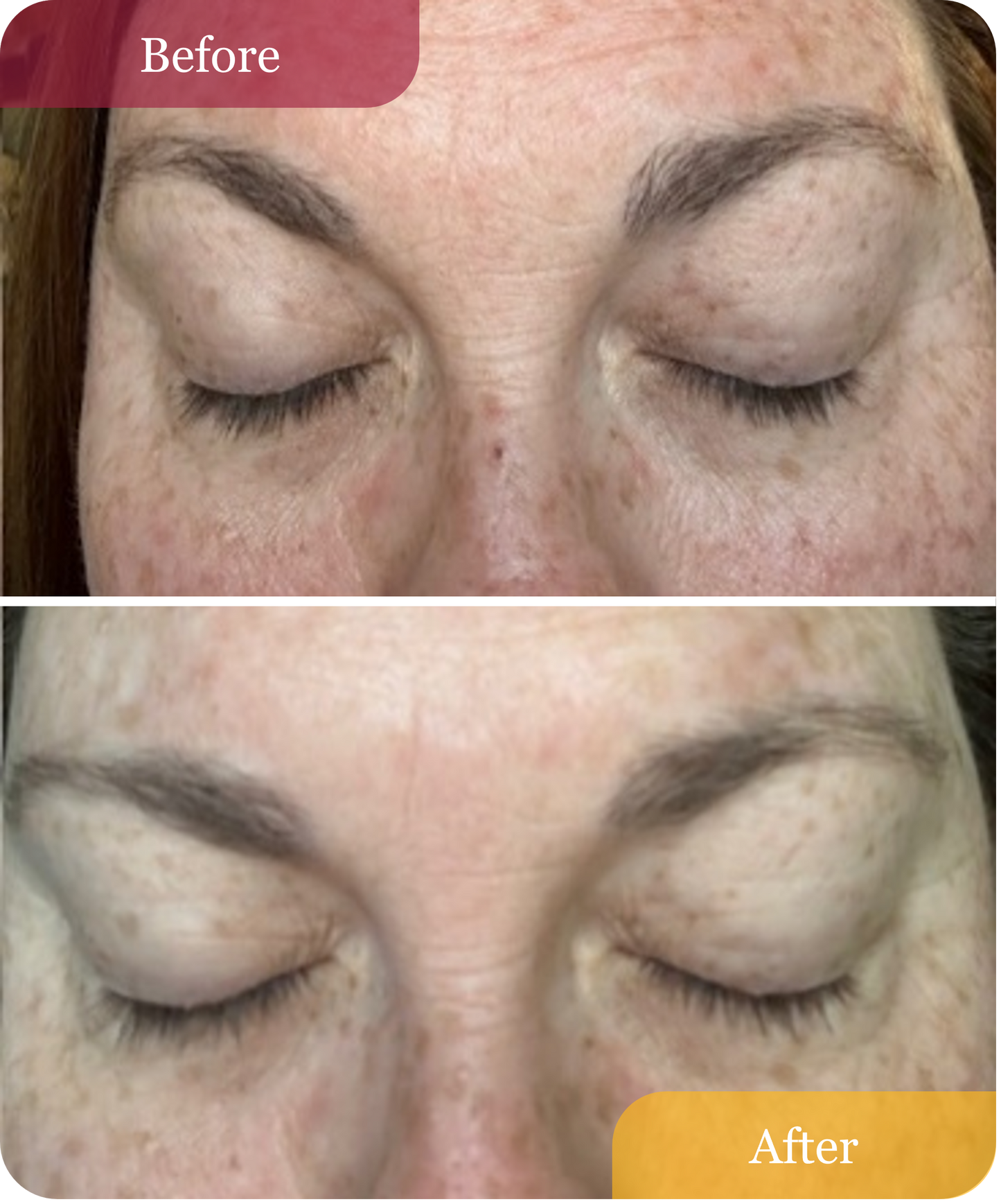 Hydrating Dew Moisturizer