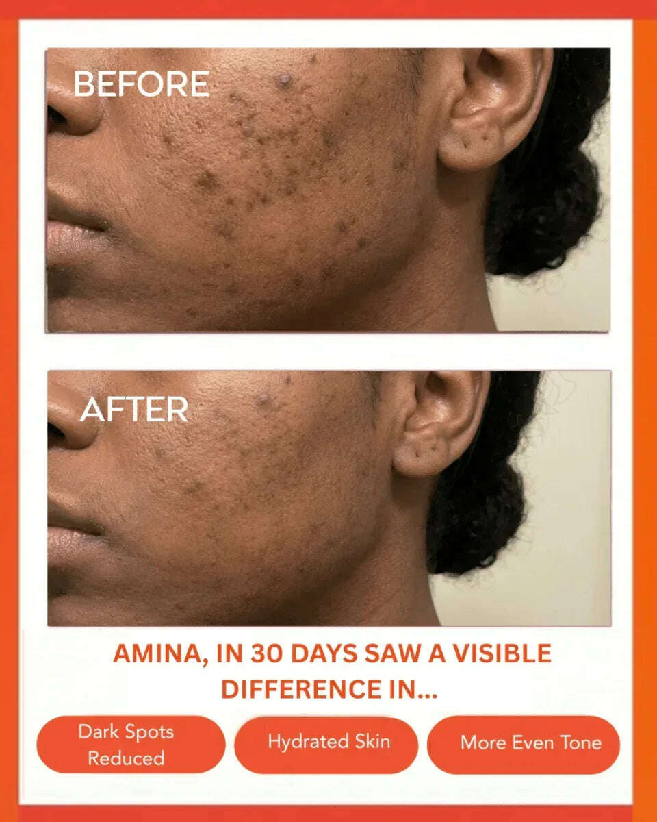 clear-confidence-moisturizer-35847415