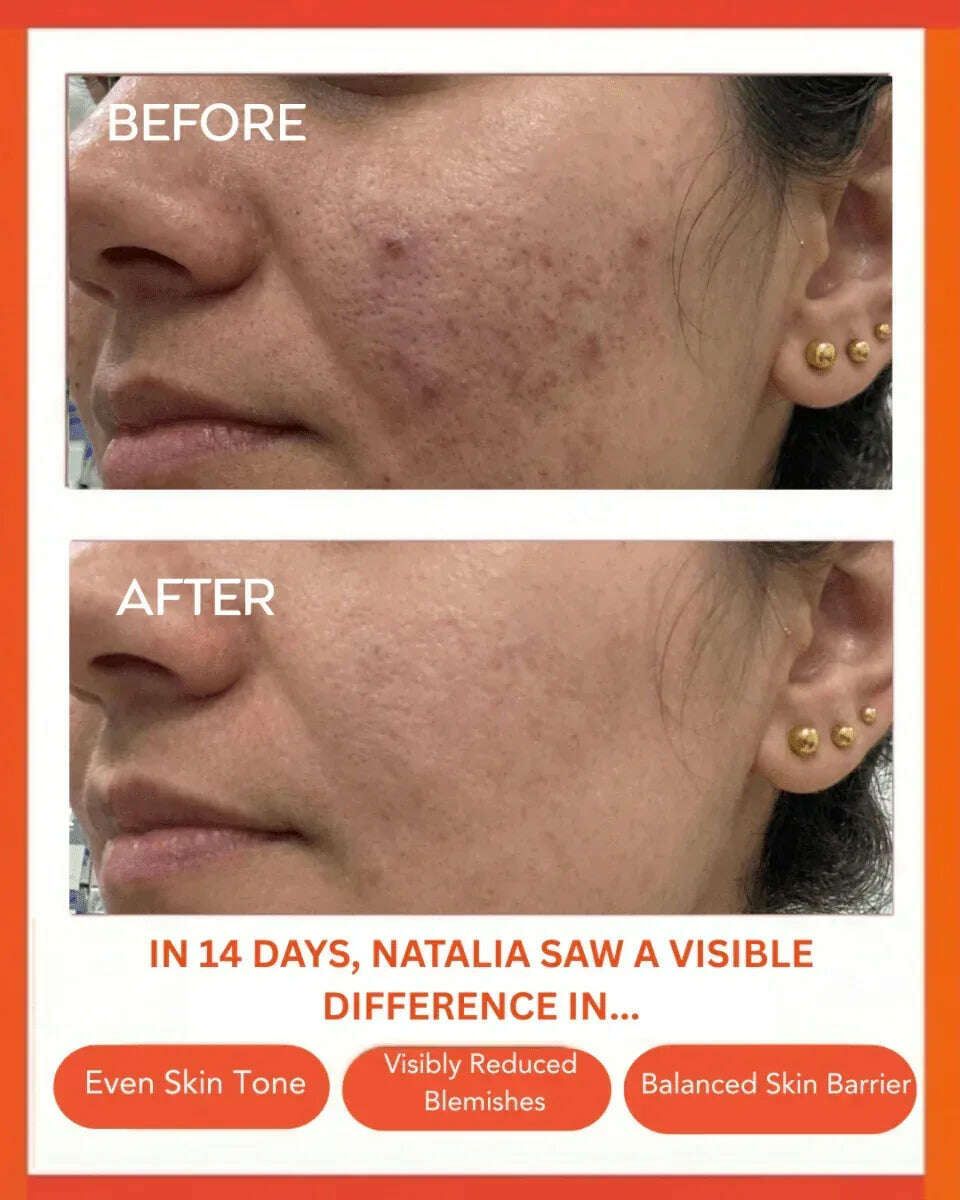 clear-confidence-moisturizer-35847416