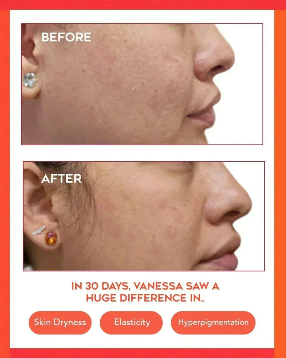 hydrating-dew-moisturizer-35847395