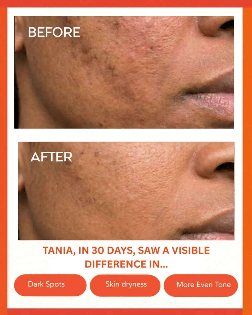 hydrating-dew-moisturizer-35847392