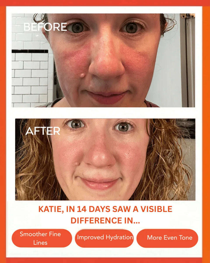 hydrating-dew-moisturizer-35847393